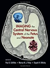 IMAGING OF THE CENTRAL NERVOUS SYSTEM OF THE FETUS AND NEONATE