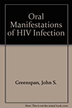 ORAL MANIFESTATIONS OF HIV INFECTION