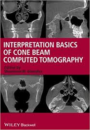 INTERPRETATION BASICS OF CONE BEAM COMPUTED TOMOGRPHY, 1ED:2014