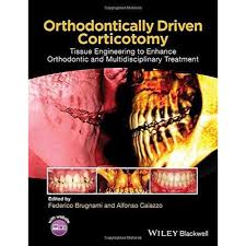 ORTHODONTICALLY DRIVEN CORTICOTOMY: TISSUE ENGINEERING TO ENHANCE ORTHODONTIC AND MULTIDISCIPLINARY