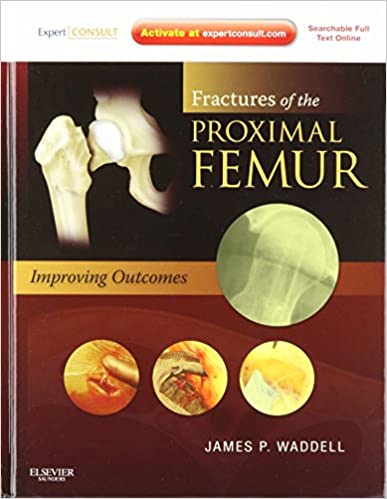 FRACTURES OF THE PROXIMAL FEMUR: IMPROVING OUTCOMES (HB)