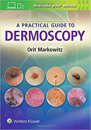 A PRACTICAL GUIDE TO DERMOSCOPY (PB)