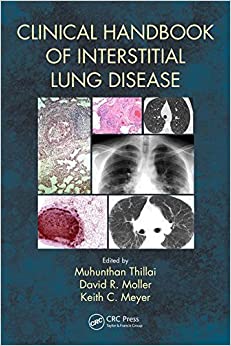 Clinical Handbook of Interstitial Lung Disease (PB)