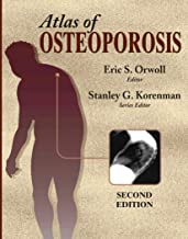 ATLAS OF OSTEOPOROSIS
