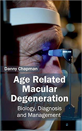 AGE RELATED MACULAR DEGENERATION: BIOLOGY, DIAGNOSIS AND MANAGEMENT