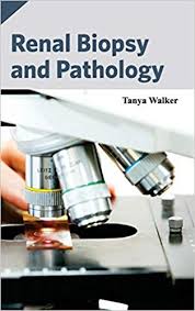 RENAL BIOPSY AND PATHOLOGY