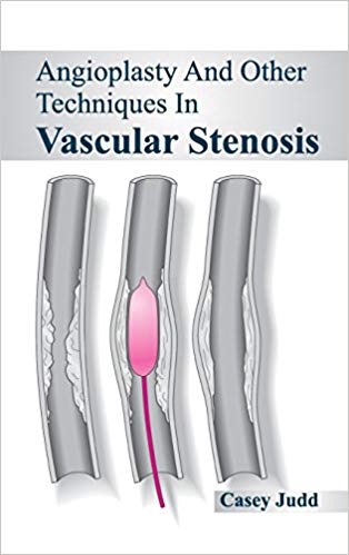 ANGIOPLASTY AND OTHER TECHNIQUES IN VASCULAR STENOSIS : 1/E 2015