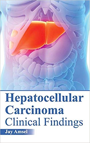 HEPATOCELLULAR CARCINOMA: CLINICAL FINDINGS; 1/E 2015