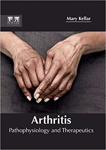 ARTHRITIS: PATHOPHYSIOLOGY AND THERAPEUTICS; 1/E 2017