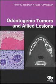 ODONTOGENIC TUMORS & ALLIED LESIONS (HB)