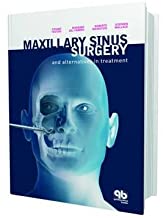 Maxillary Sinus surgery and Alternatives in Treatment (HB)