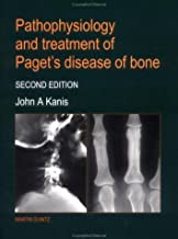 PATHOPHYSIOLOGY AND TREATMENT OF PAGET'S DISEASE OF BONE, 2E