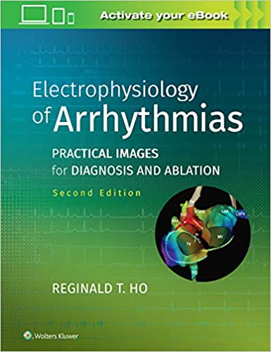 ELECTROPHYSIOLOGY OF ARRHYTHMIAS: PRACTICAL IMAGES FOR DIAGNOSIS AND ABLATION, 2E (HB)