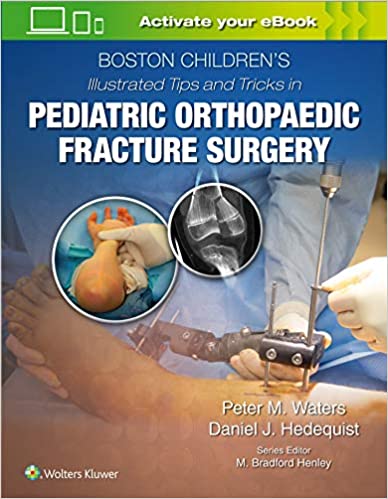 BOSTON CHILDRENS ILLUSTRATED TIPS AND TRICKS IN PEDIATRIC ORTHOPAEDIC FRACTURE SURGERY (HB 2020)