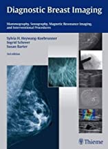 DIAGNOSTIC BREAST IMAGING MAMMOGRAPHY SONOGRAPHY M