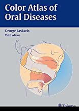 COLOR ATLAS OF ORAL DISEASES