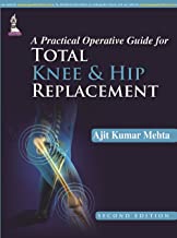 A PRACTICAL OPERATIVE GUIDE FOR TOTAL KNEE AND HIP REPLACEMENT